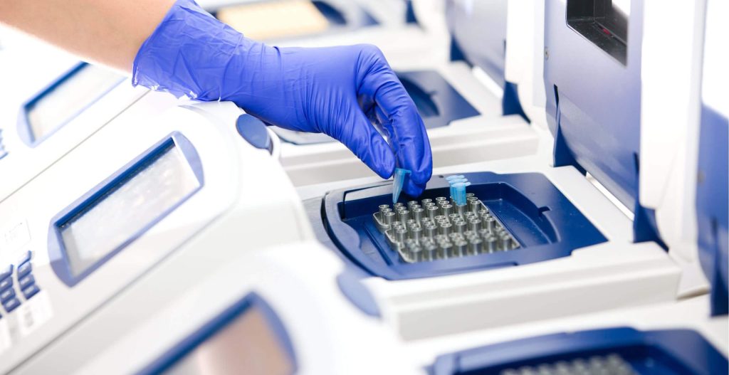 HPV परीक्षणको बारेमा जानकारी